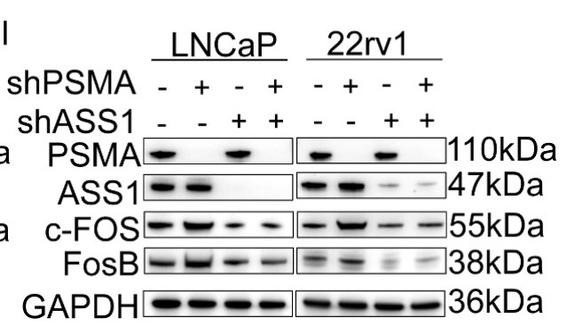 After the knockdown of both PSMA and ASS1, kits were used to detect the concentrations of arginine and proline.jpg